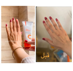 handcream-before-after